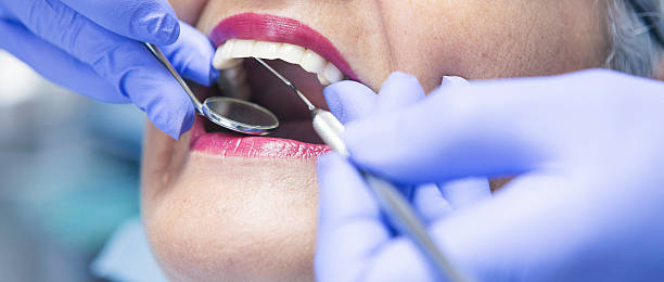 Best Emergency Wisdom Teeth Removal in Sharon Center, OH