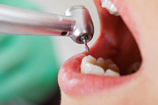 Best Emergency Treatment for Toothache in Sharon Center, OH